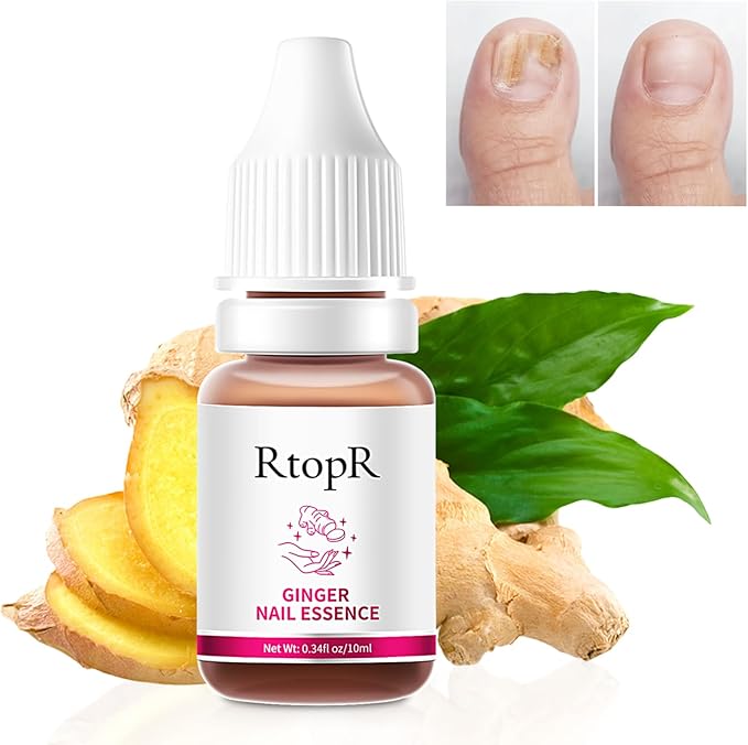 RtopR® 3 in 1 (Nail Repairer, Restorer and Strengthener)