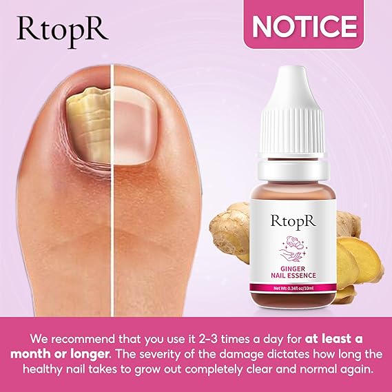 RtopR® 3 in 1 (Nail Repairer, Restorer and Strengthener)