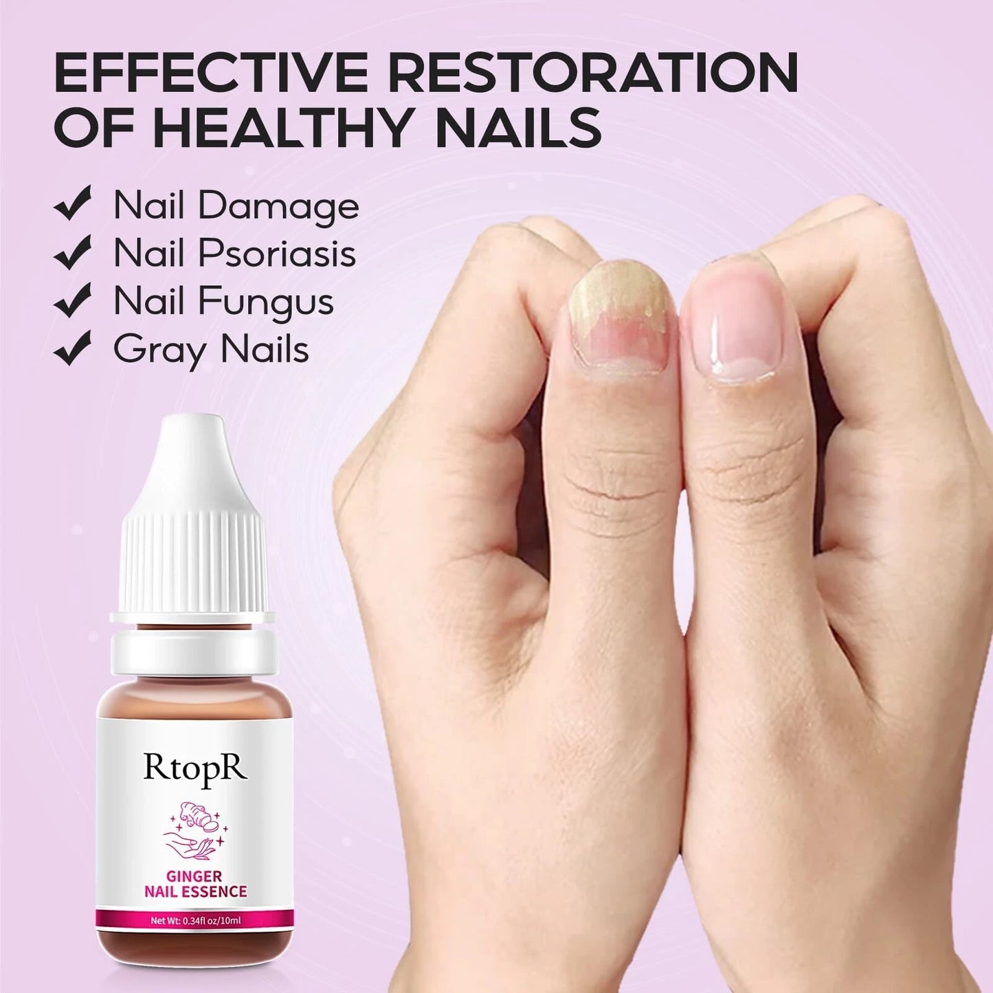 RtopR® 3 in 1 (Nail Repairer, Restorer and Strengthener)