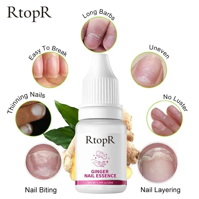 RtopR® 3 in 1 (Nail Repairer, Restorer and Strengthener)